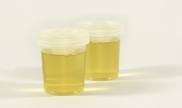 Récipient D'urine